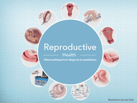 reproductive health Reproductive health is an important component of men's overall health and well-being too often, males have been overlooked in discussions of reproductive health, especially when. reproductive health Reproductive health is an important component of men's overall health and well-being too often, males have been overlooked in discussions of reproductive health, especially when.