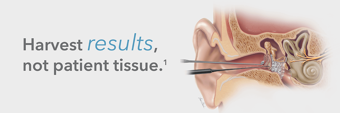 Harvest results, not patient tissue