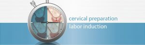 Cervical preparation vs. labour induction