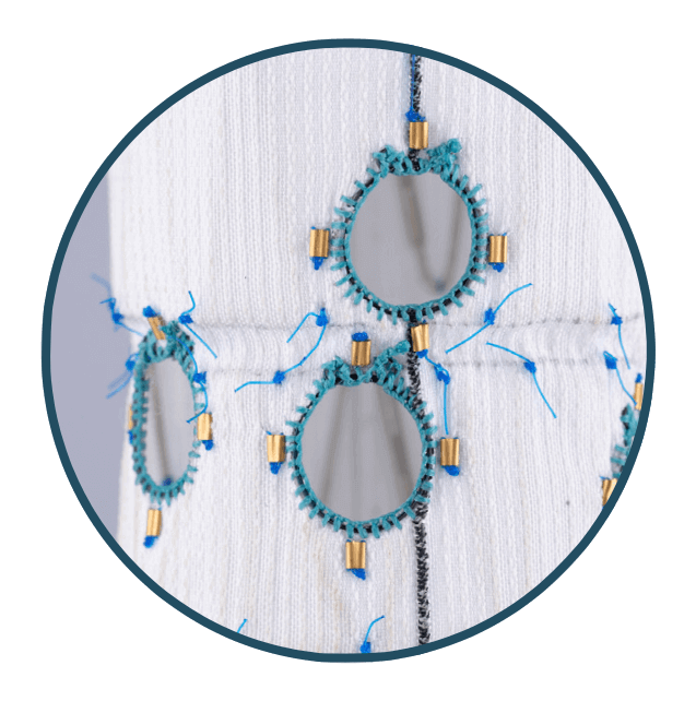 A custom thoracoabdominal device showing fenestrations.