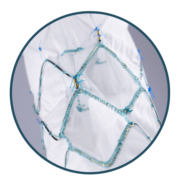 A custom thoracoabdominal device showing inner branches.