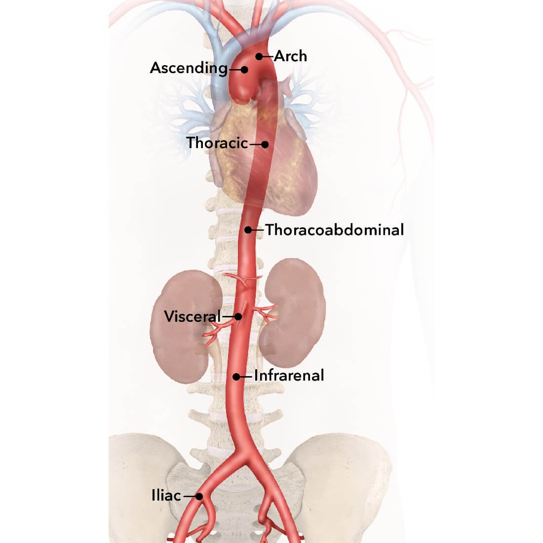 Anatomy of aorta, with labels for sections including the arch, ascending, thoracic, thoracoabdominal, visceral, infrarenal, and iliac.