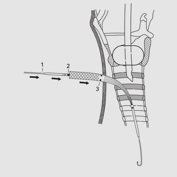 Procedural guide