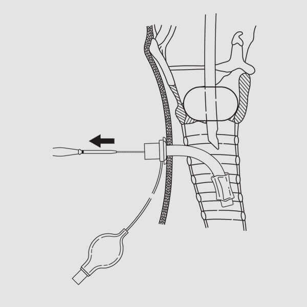 Procedural guide